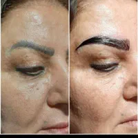 کاشت مو پرتراکم اقساطی با پرداخت 4میلیون تومان|خدمات آرایشگری و زیبایی|اصفهان, میرعماد|دیوار