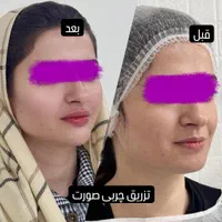 مژده ب همشهریان عزیزم آف چهل درصدی جراحی زیبایی
