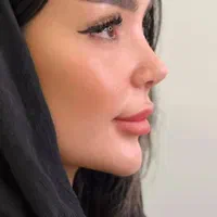 جشنواره جراحی بینی