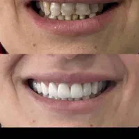 دندانپزشکی مهر با تخفیف‌های ویژه|خدمات آرایشگری و زیبایی|تهران, جنت‌آباد جنوبی|دیوار