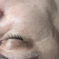 مدل پاکسازی و فیشال پوست با ۴ سال سابقه کار|خدمات آرایشگری و زیبایی|مشهد, صیاد شیرازی|دیوار