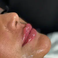 آموزش و خدمات فیشال وماساژ نخ کلاژن بوتاکس فیلرمزو|خدمات آرایشگری و زیبایی|شیراز, بعثت|دیوار