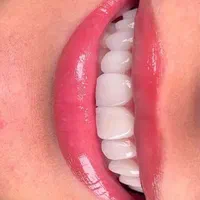 بدون درد بدون استرس درمان تخصصی دندان