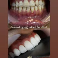 کلینیک تخصصی دندانپزشکی امین|خدمات آرایشگری و زیبایی|مشهد, چهارچشمه|دیوار