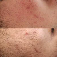 خدمات فیشال و اموزش تخصصی فیشیال|خدمات آرایشگری و زیبایی|شیراز, فرهنگ شهر|دیوار