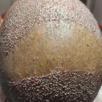 جشنواره کاشت مو باقیمت مناسب|خدمات آرایشگری و زیبایی|شیراز, قصرالدشت|دیوار
