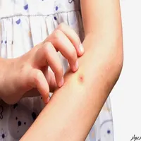 سمپاشی منزل تخصصی ساس سوسک موش سم پاشی کل تهران|خدمات نظافت|تهران, افسریه|دیوار