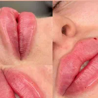 کلینیک تزریق ژل و بوتاکس و آنزیم پزشک|خدمات آرایشگری و زیبایی|کرج, باغستان|دیوار
