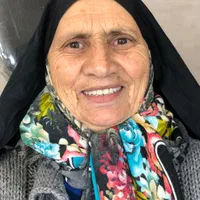 دندان مصنوعی قرارداد بابیمه دندانسازی|خدمات آرایشگری و زیبایی|یزد, |دیوار