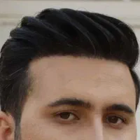 کاشت مو و ابرووریش حداکثر تراکم باضمانت نامه کتبی|خدمات آرایشگری و زیبایی|شیراز, عفیف‌آباد|دیوار