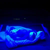 اجاره و درمان زردی نوزاد درفردیس