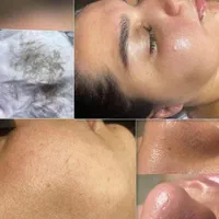 فیشال و پاکسازی پوست|خدمات آرایشگری و زیبایی|اصفهان, خواجو|دیوار