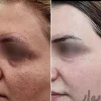 کرم معجزهvipصدرصداصلی ضدلک و روشن کننده|آرایشی، بهداشتی، درمانی|تهران, امام زاده حسن|دیوار