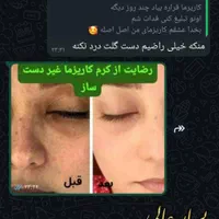 کرم کاریزما سفید کننده قوی اماراتی|آرایشی، بهداشتی، درمانی|شیراز, سیاه سنگ|دیوار