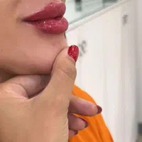 ژل لب