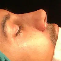 خدمات عمل جراحی زیبایی بینی و ترمیم بینی|خدمات آرایشگری و زیبایی|تهران, فلاح|دیوار