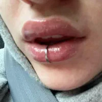 جشنواره فیلر ژل لب چال لپ کاشت نگین دندان پیرسینگ|خدمات آرایشگری و زیبایی|زنجان, |دیوار