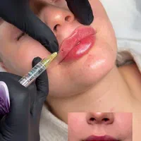 کیلینک دکتر مصطفی یوسفی مقدم زیبایی پوست مو|خدمات آرایشگری و زیبایی|قم, حاج زینل|دیوار