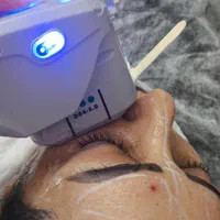 لاغری با دستگاه پاکسازی فیشال هایفو تراپی|خدمات آرایشگری و زیبایی|زنجان, |دیوار