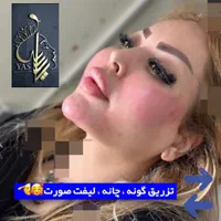 تزریق ژل وبوتاکس ومادلینگ اروپایی وهایفو درکلینیک|خدمات آرایشگری و زیبایی|کرمانشاه, |دیوار