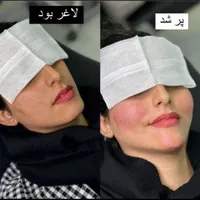 خدمات تخصصی ژل و بوتاکس|خدمات آرایشگری و زیبایی|شاهین‌شهر, فردوسی|دیوار
