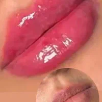 لیزر فول بادی بانوان ۳۰۰اقایان ۶۰۰تزریق ژل لب ۵۵۰