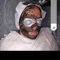 مرکز لیزر رز (پاک تتو و کربن تراپی)|خدمات آرایشگری و زیبایی|مشهد, هنرور|دیوار