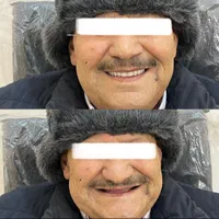 دندانسازی میعاد دندان مصنوعی|خدمات آرایشگری و زیبایی|کرمان, |دیوار