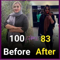 جراحی عمل اسلیومعده/اسلیو معده/چاقی لاغری/اسلیو|خدمات آرایشگری و زیبایی|تهران, چیتگر جنوبی|دیوار