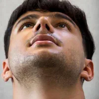 عمل بینی فقط ۲۵م باروشی جدیدبدون درد+مشاوره رایگان|خدمات آرایشگری و زیبایی|شیراز, فرهنگ شهر|دیوار