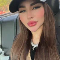 فیلر بوتاکس اقتصادی فقط ۴۰۰|خدمات آرایشگری و زیبایی|اصفهان, شهشهان|دیوار