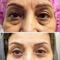 مژده ب همشهریان عزیزم آف چهل درصدی جراحی زیبایی|خدمات آرایشگری و زیبایی|دورود, |دیوار
