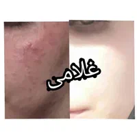 کرم معجزه ونوس لایف غلامی|آرایشی، بهداشتی، درمانی|شیراز, شیخ علی چوپان|دیوار