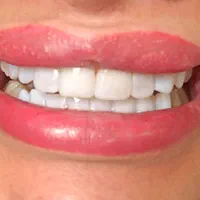 دندانپزشکی نقد و اقساط باتخفیفات بینظیر دندانپزشکی|خدمات آرایشگری و زیبایی|شیراز, قصرالدشت|دیوار