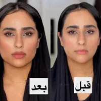 ژل لب بوتاکس لیزر فیلر هایفوبلفاروپلاستی|خدمات آرایشگری و زیبایی|مشهد, فرهنگ|دیوار