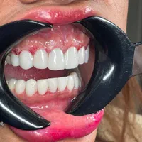 کلیه خدمات دندانپزشکی/اقساط12ماهه/بدون کارمزد|خدمات آرایشگری و زیبایی|قم, حنیف نژاد|دیوار
