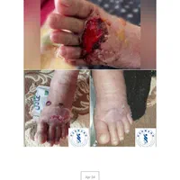 کلینیک تخصصی درمان انواع زخم(بستر و دیابت) فردوس|خدمات آرایشگری و زیبایی|اصفهان, محله سفلی|دیوار