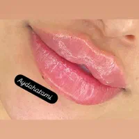 اف تزریق ژل و بوتاکس توسط کادر درمان در کلینیک|خدمات آرایشگری و زیبایی|اهواز, پادادشهر|دیوار