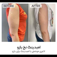 لاغری در سه هفته|خدمات آرایشگری و زیبایی|شیراز, معالی‌آباد|دیوار