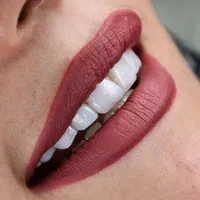 دندانپزشکی زیبایی-درمانی درمطب (خیابان جابرانصاری)|خدمات آرایشگری و زیبایی|اصفهان, میرعماد|دیوار