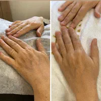فیشال و خدمات تخصصی پوست توسط پیراپزشک در مطب پزشک|خدمات آرایشگری و زیبایی|مشهد, سجاد شهر|دیوار