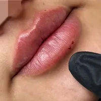 مطب تخفیف ژل و فیلر لب و صورت و بوتاکس|خدمات آرایشگری و زیبایی|قم, صفائیه|دیوار