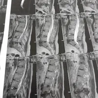 طب فیزیکی سنتی دررفتگی مفاصل دیسک کمر گردن سیاتیک|خدمات آرایشگری و زیبایی|قم, عمار یاسر|دیوار