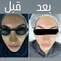 فیشیال و پاکسازی پوست فقط ۲۵۰ت
