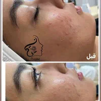 جشنواره  تابستانه  آموزش وخدمات پاکسازی فیشال|خدمات آرایشگری و زیبایی|مشهد, آزادشهر|دیوار