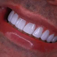 خدمات دندان پزشکی لمینت و کامپوزیت زیبایی|خدمات آرایشگری و زیبایی|تهران, جمهوری|دیوار