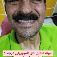 دندان مصنوعی خارجی8 سال ضمانت با بیمه دارای مجوز|خدمات آرایشگری و زیبایی|کرج, مصباح|دیوار