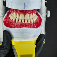 دندان مصنوعی باجدیدترین متد جهانی بدونه لقی|خدمات آرایشگری و زیبایی|شهرکرد, |دیوار