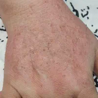 مدل پاکسازی و فیشال پوست با ۴ سال سابقه کار|خدمات آرایشگری و زیبایی|مشهد, صیاد شیرازی|دیوار