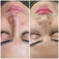 آموزش وخدمات فیشال تخصصی و پرسینگ و برداشتن خال|خدمات آرایشگری و زیبایی|تهران, فلاح|دیوار